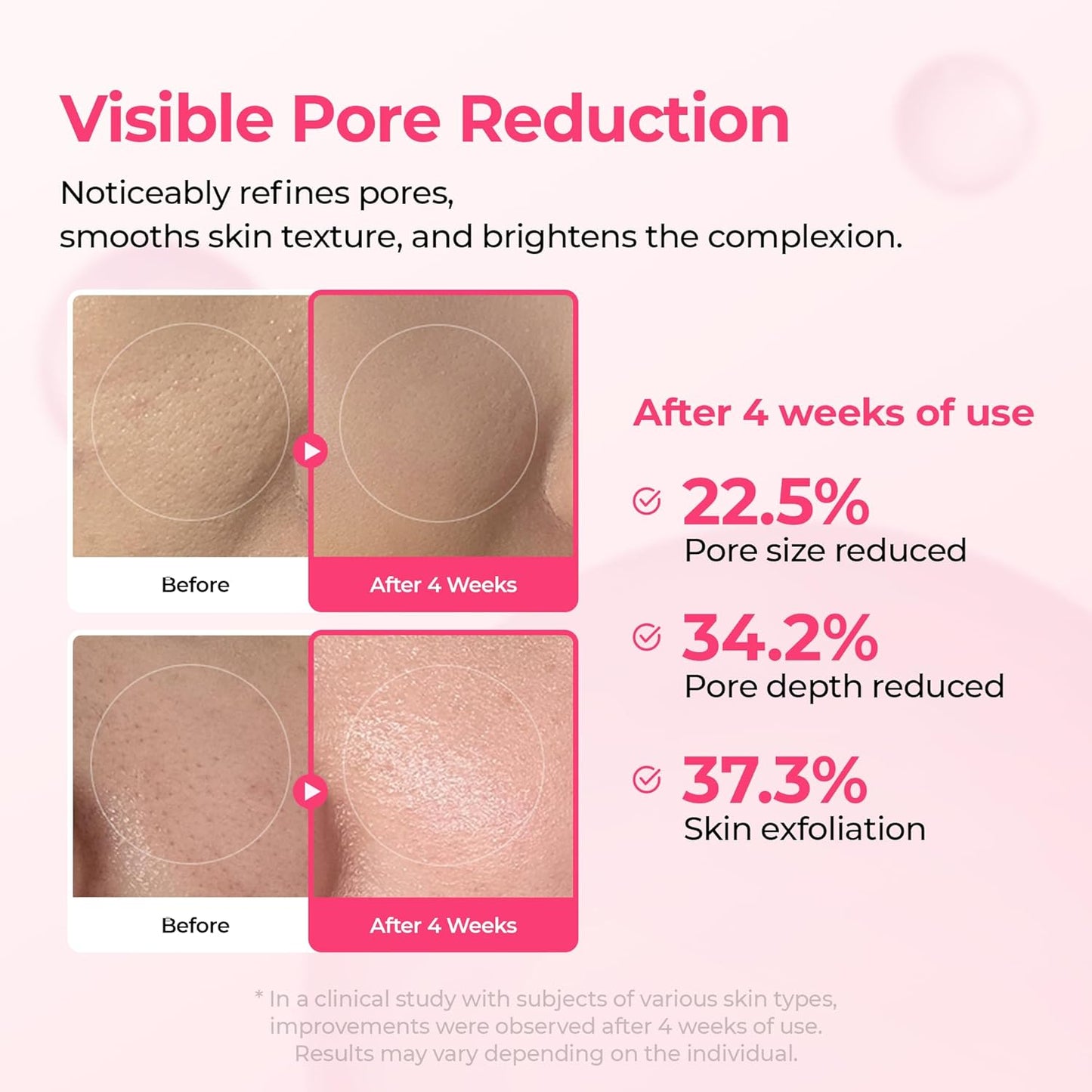 🔥Christmas Special Offer🔥Gifted Collagen Boost five Step Set Calcium Collagen Balm for Firming & Pore Care